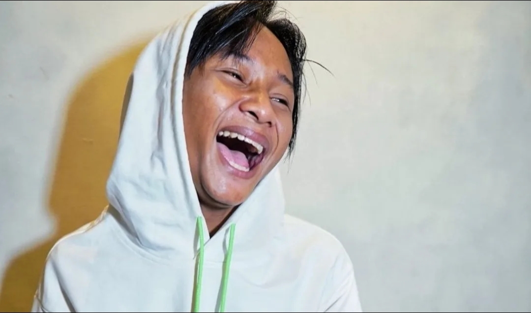 Fajar Sadboy Kecelakaan Motor Cukup Parah, Kuku hingga Tulang Bergeser