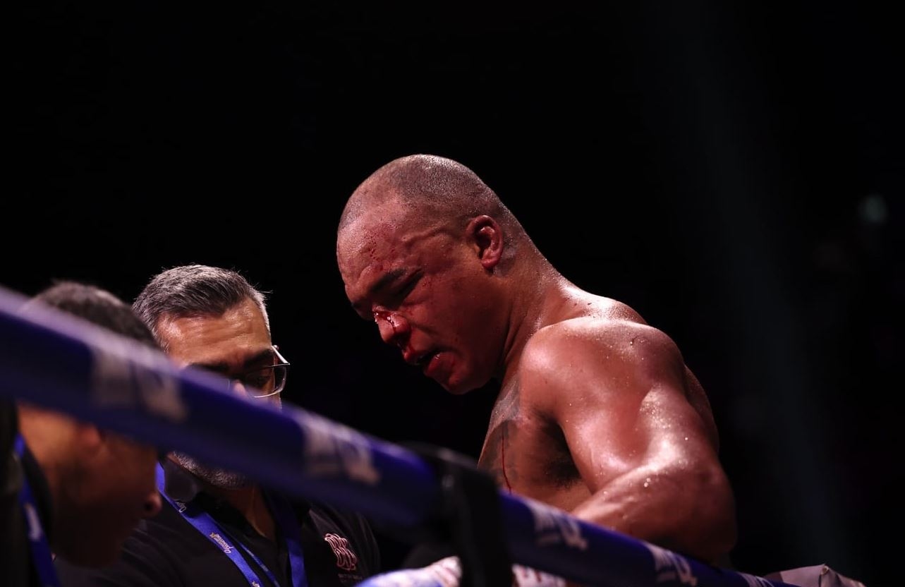 Tagih Utang, Fabio Wardley Aktifkan Klausul Rematch Kontra Daniel Dubois