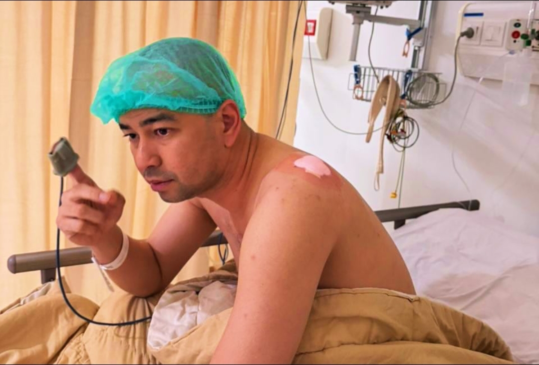 Bahu Bengkak hingga 6 Cm, Raffi Ahmad Mendadak Naik Meja Operasi karena Benjolan Misterius