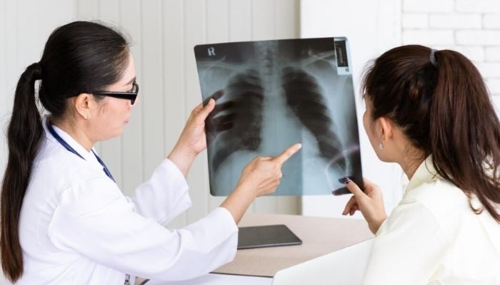 Tes Mantoux TBC: Cara Deteksi Dini Tuberkulosis Lewat Kulit