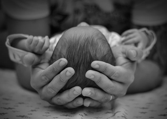 Apa Itu Mikrosefalus? Ini Dia Penyebab Dan Cara Mengatasinya Pada Bayi