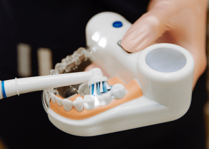 Seram Banget, Ini Dampak Gigi Berlubang Pada Kesehatan