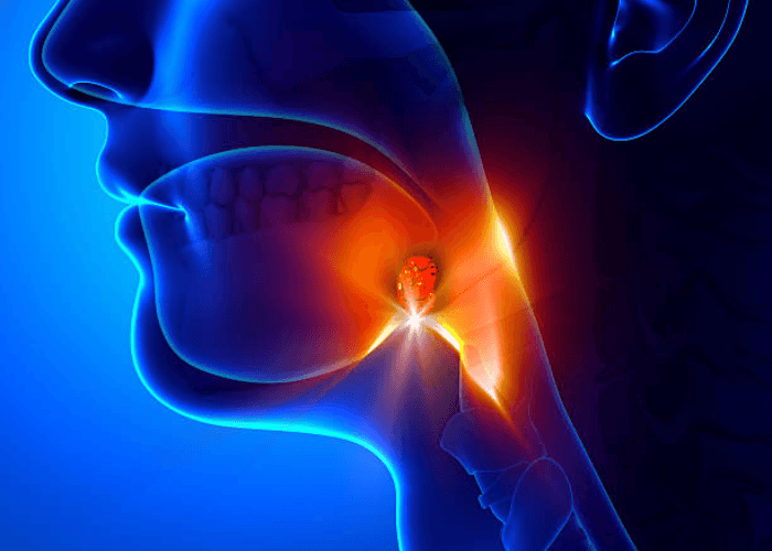 Amandel, Fakta, Gejala, Dan Pengobatannya