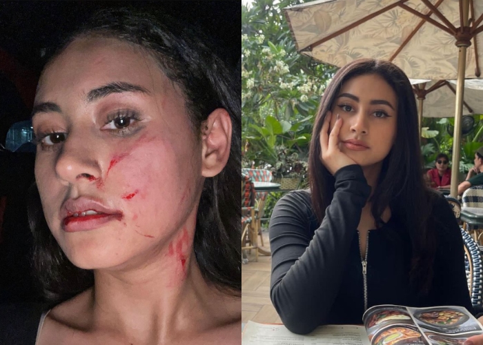 Profil Afifah Riyad, Selebgram Korban Penganiayaan Mantan Pacar Suami