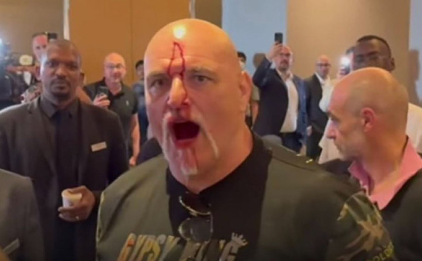 Adu Kepala dengan Anggota Rombongan Oleksandr Usyk di Riyadh, Kepala Ayah Tyson Fury Berdarah!