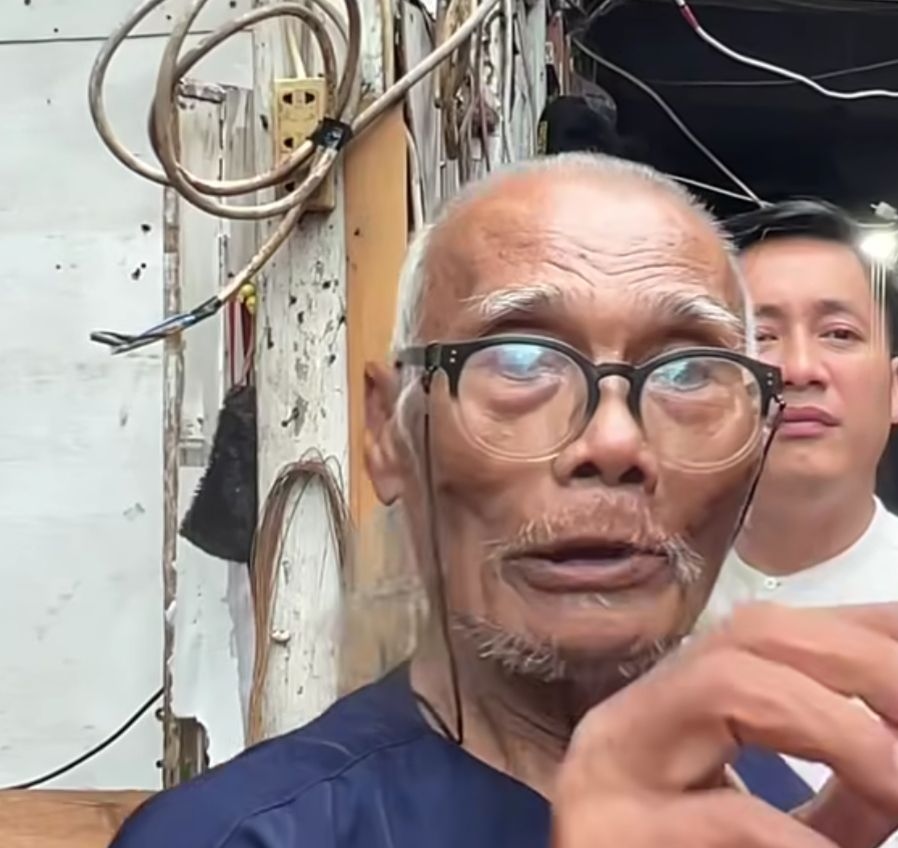 Kondisi Terkini Diding Boneng: Sesak Napas Hebat, Kini Berangsur Pulih ​