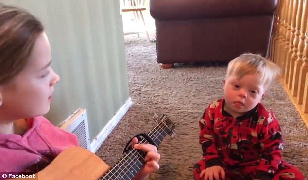 Mengenali Tanda Awal Down Syndrome pada Anak Sejak Dini