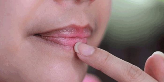 Cara Memerahkan Bibir Hitam Secara Alami dan Permanen