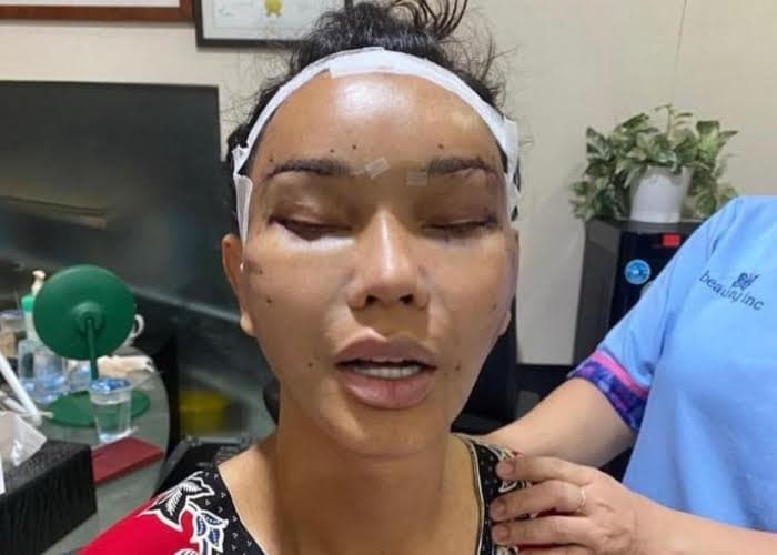 Bunda Corla Langsung Bikin Heboh! Lakukan Perawatan Kecantikan Senilai Rp1,5 Miliar Pas Di Indonesia