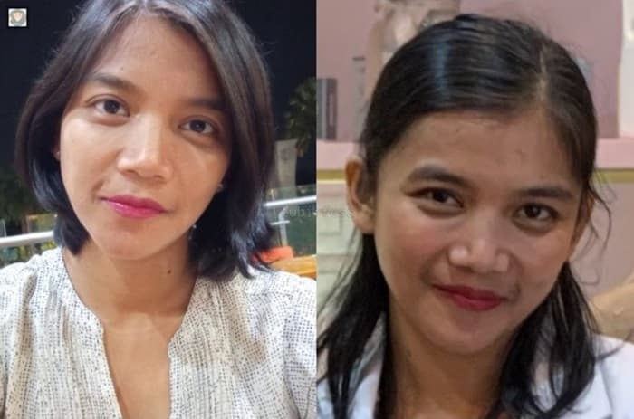 Dokter Qory Lulusan Mana, Simak Profil Lengkap Akun Instagram, X Twitter Beserta Klinik Dan Rumah Sakit Tempat Praktiknya