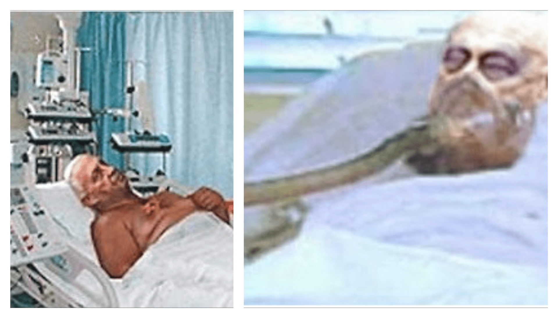 Ketika Ex PM Israel Ariel Sharon 8 Tahun Koma Sebelum Meninggal, Apa yang Terjadi?