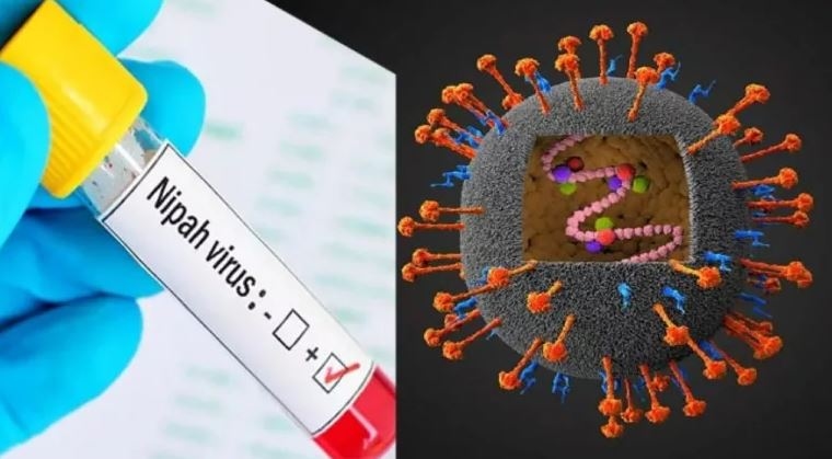 5 Fakta Virus Nipah, Dapat Menular Lewat Makanan Yang Terkontaminasi