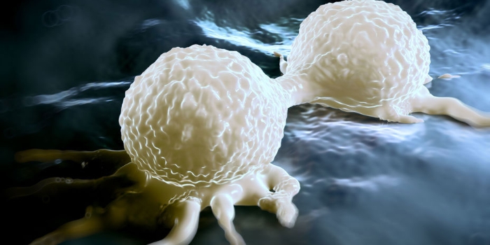 Kenali Tanda-tanda Metastasis, Penyebaran Sel Kanker Ke Jaringan Tubuh