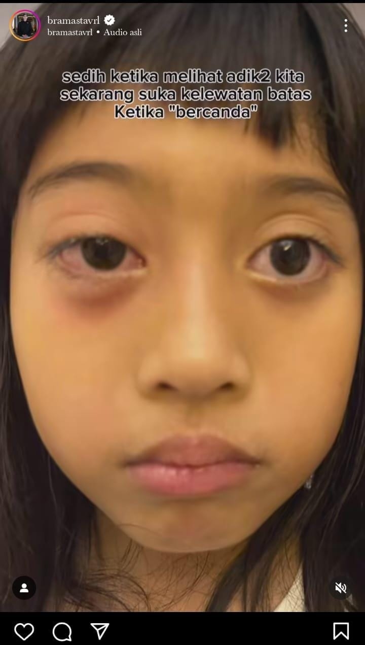 Habis Venna Melinda, Terbitlah Vanya Korban Kekerasan, Verrell Bramasta Geram, Seberapa Parah?