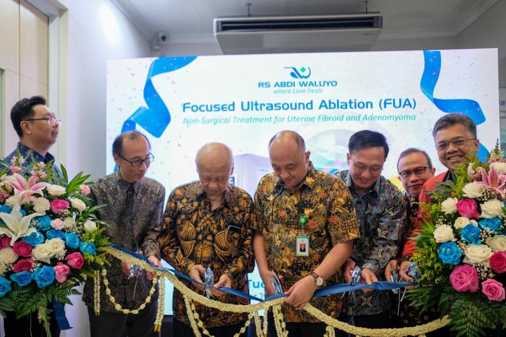 Lakukan Transformasi, RS Abdi Waluyo Hadirkan Focused Ultrasound Ablation Untuk Pasien Mioma