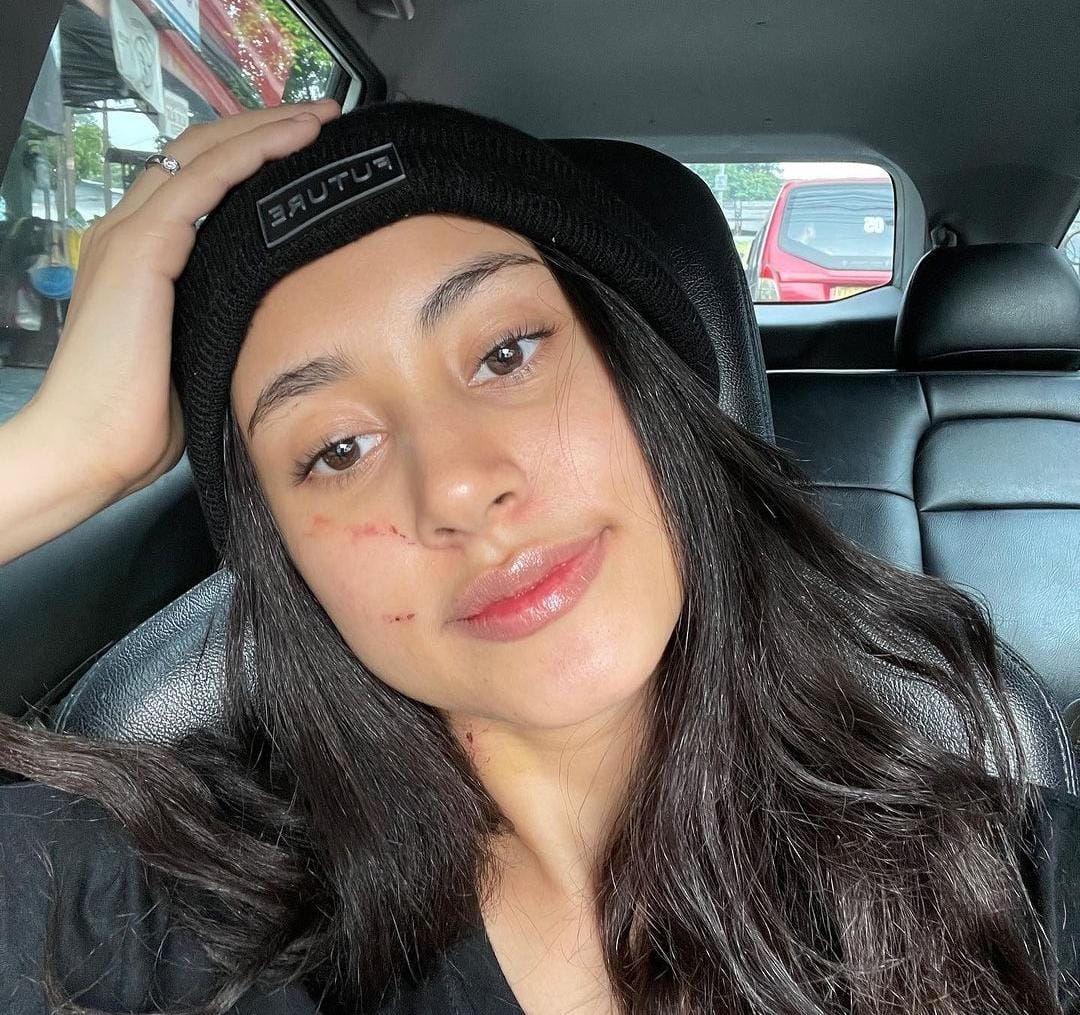 Kekerasan Selama Pacaran, Afifah Riyad Dilaporkan Balik Ke Polisi Oleh Regi Nazlah