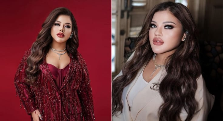 Telah Banyak Melakukan Operasi Diet Khusus, Ternyata Ini 4 Sumber Utama Kekayaan Shindy Samuel