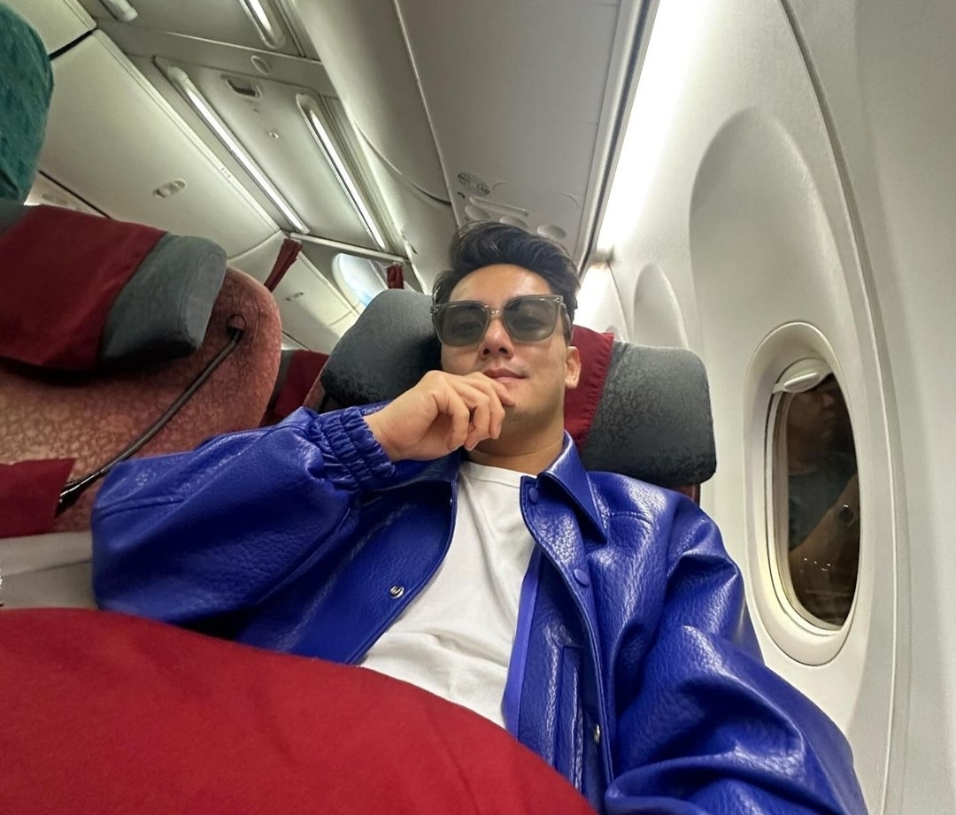 Boy William Operasi Hidung di Korea, Habiskan 1 Miliar Lebih