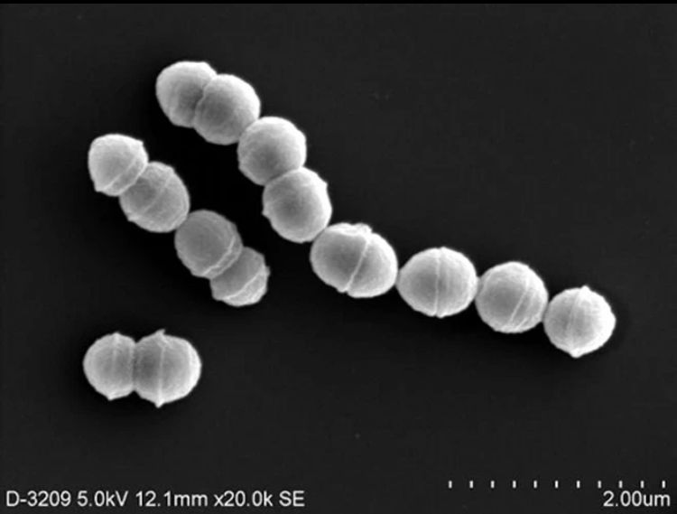 Kasus STSS Meningkat di Jepang, Virus Mematikan?