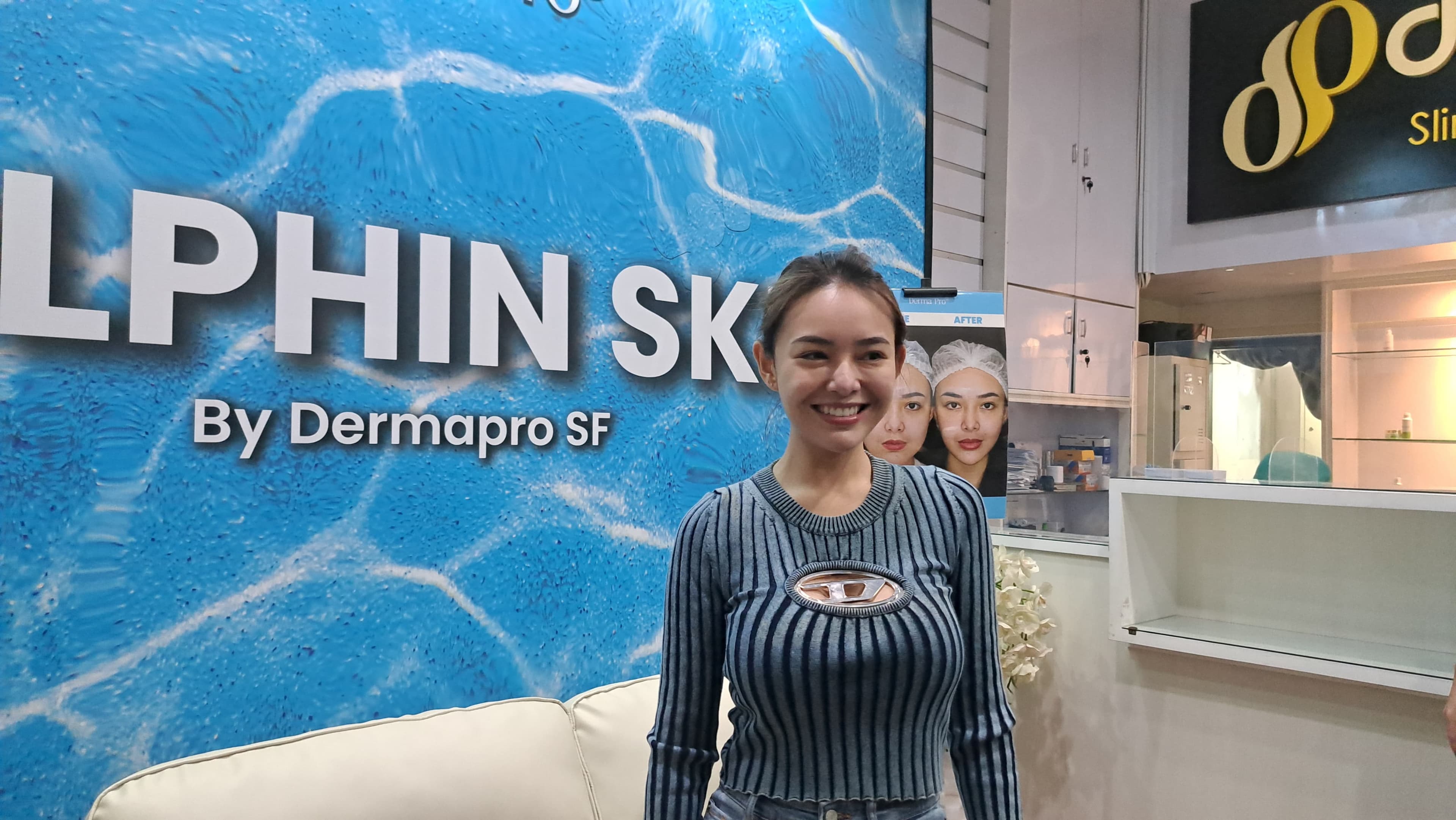 Wajahnya Dituding Oplas, Amanda Manopo Habis Belasan Juta Buat Perawatan