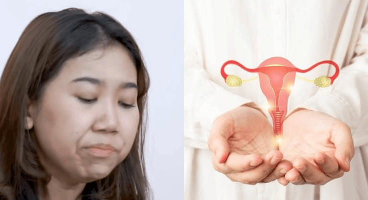 Kiky Saputri Nangis Kejer Keguguran, Ketahui Apa Itu Kista dan Apakah Bisa Sembuh?