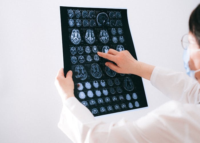 Benarkah Otak Memutar Kenangan Indah Sesaat Sebelum Meninggal?