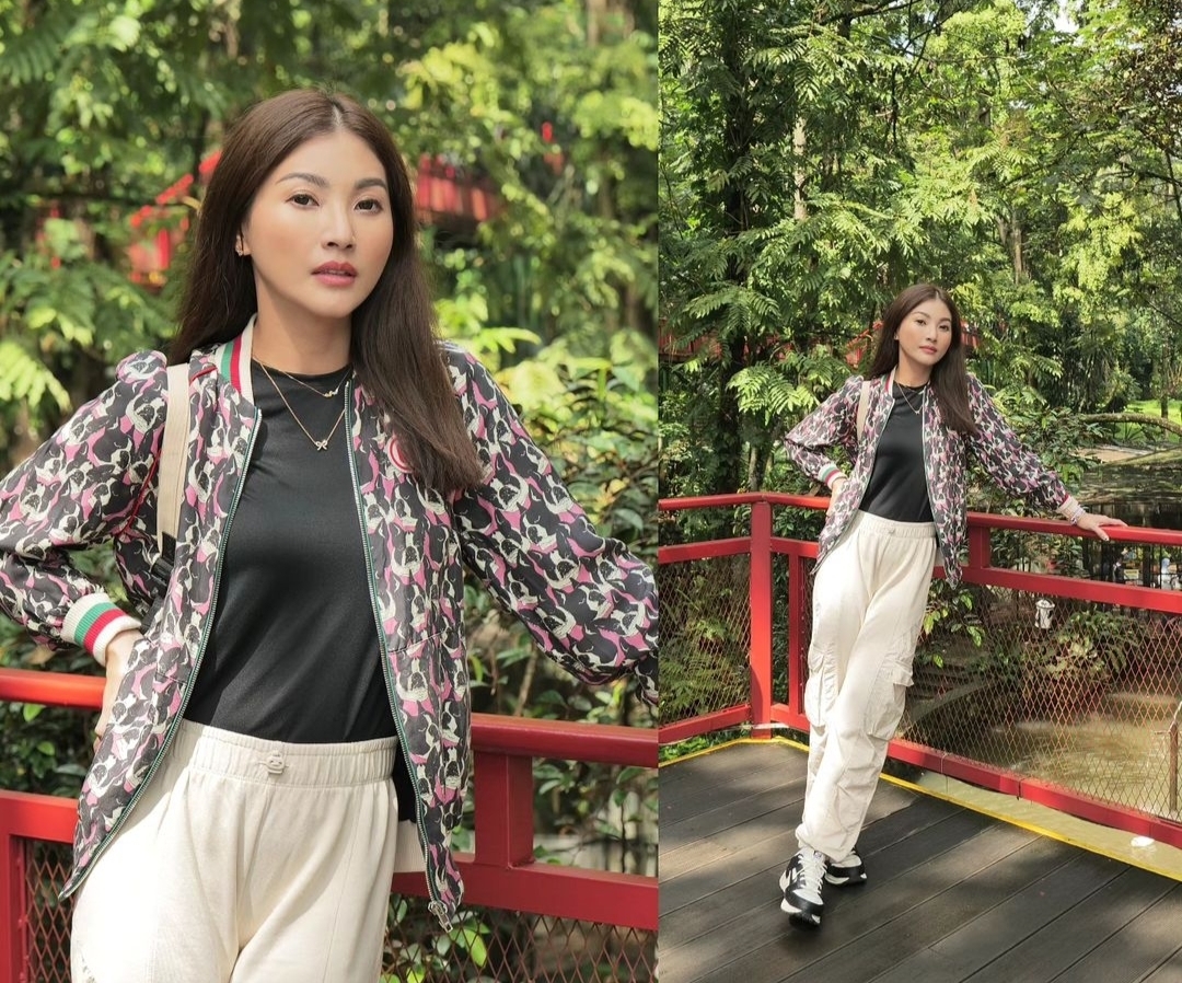 Usai Jalani Operasi, Sarwendah Ungkap Kondisinya Kini