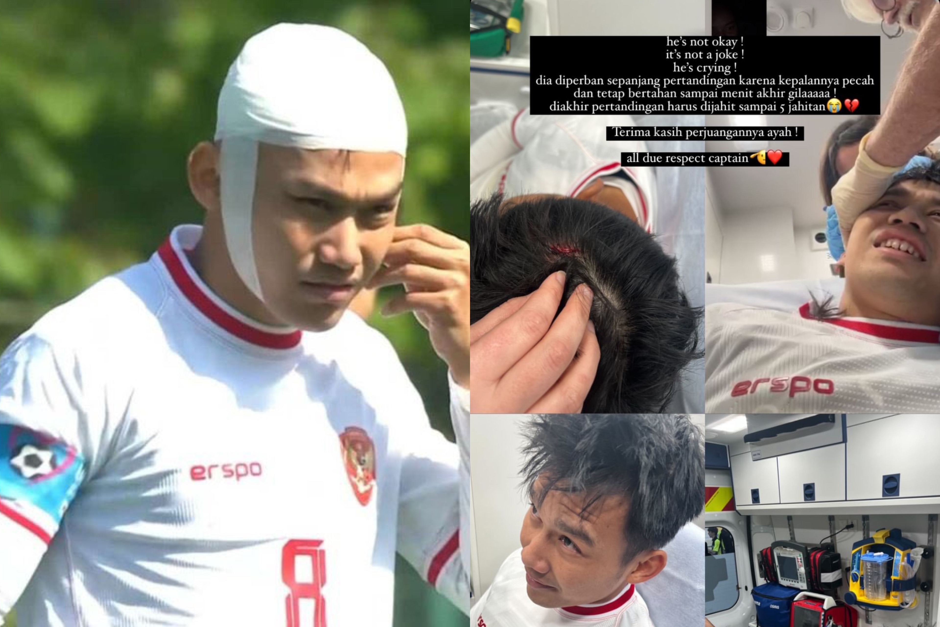 NGERI Kepala Witan Sulamean Bocor 5 Jahitan Akibat Benturan dengan Pemain Guinea, Sang Istri Bagikan Pesan Menyentuh