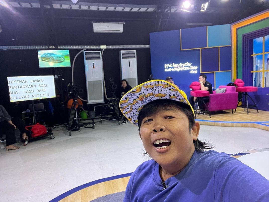 Dituding Enggak Bisa Melihat karena Glaukoma, Ini Kata Adul