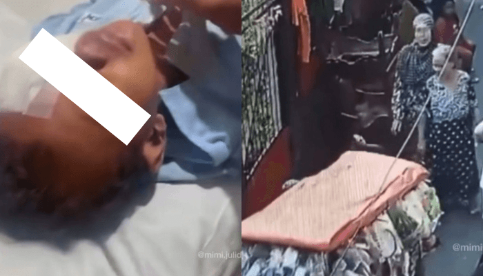 VIRAL Kronologi Bocah 7 Tahun Digigit Anjing di Jaksel, Mata Terluka hingga Dilarikan ke RS