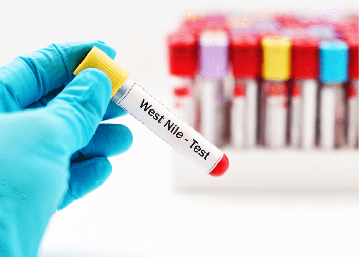 Apa Itu Virus West Nile yang Mewabah di Israel? Ini Penjelasan, Gejala dan Pencegahannya