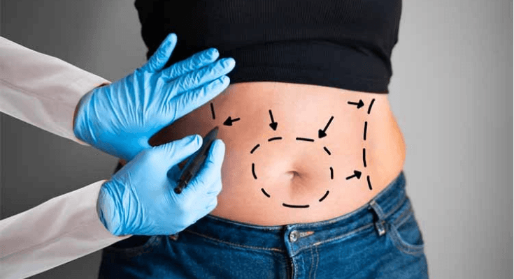 Diduga Korban Malapraktik, Ini Kronologi Selebgram Ella Nanda Sari Tewas Usai Sedot Lemak di Klinik Kecantikan Depok!