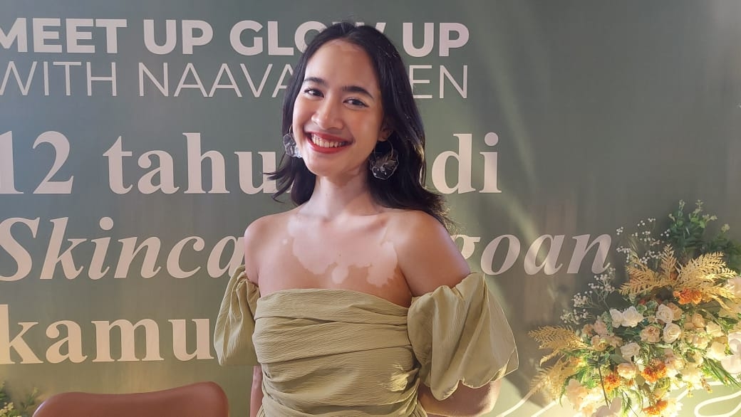 12 Tahun Naavagreen, Salma Kyana Cerita Jadi Korban Bully: Cantik Soal Seberapa Besar Wanita Merasa Berharga