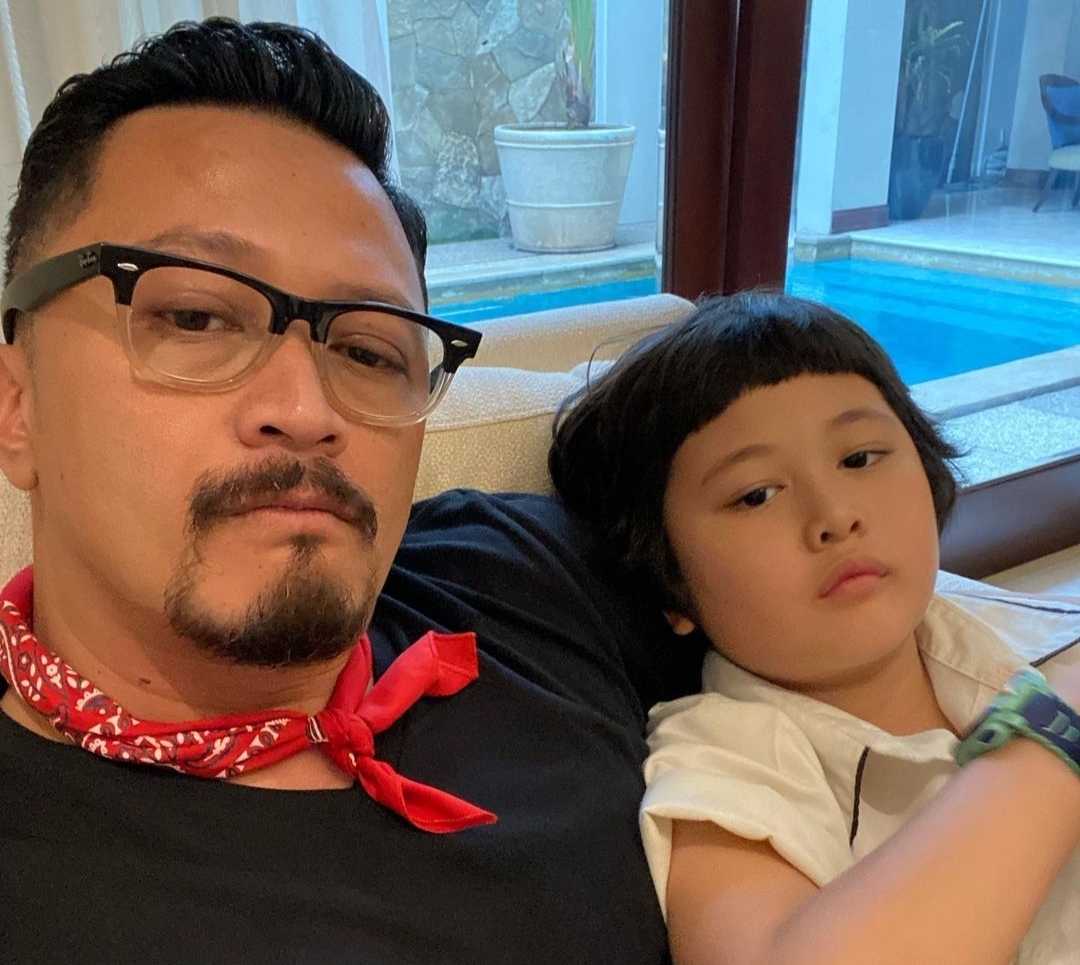 Cedera Serius di Tulang Bagian Belakang, Ferry Maryadi Dapat Perawatan Intensif