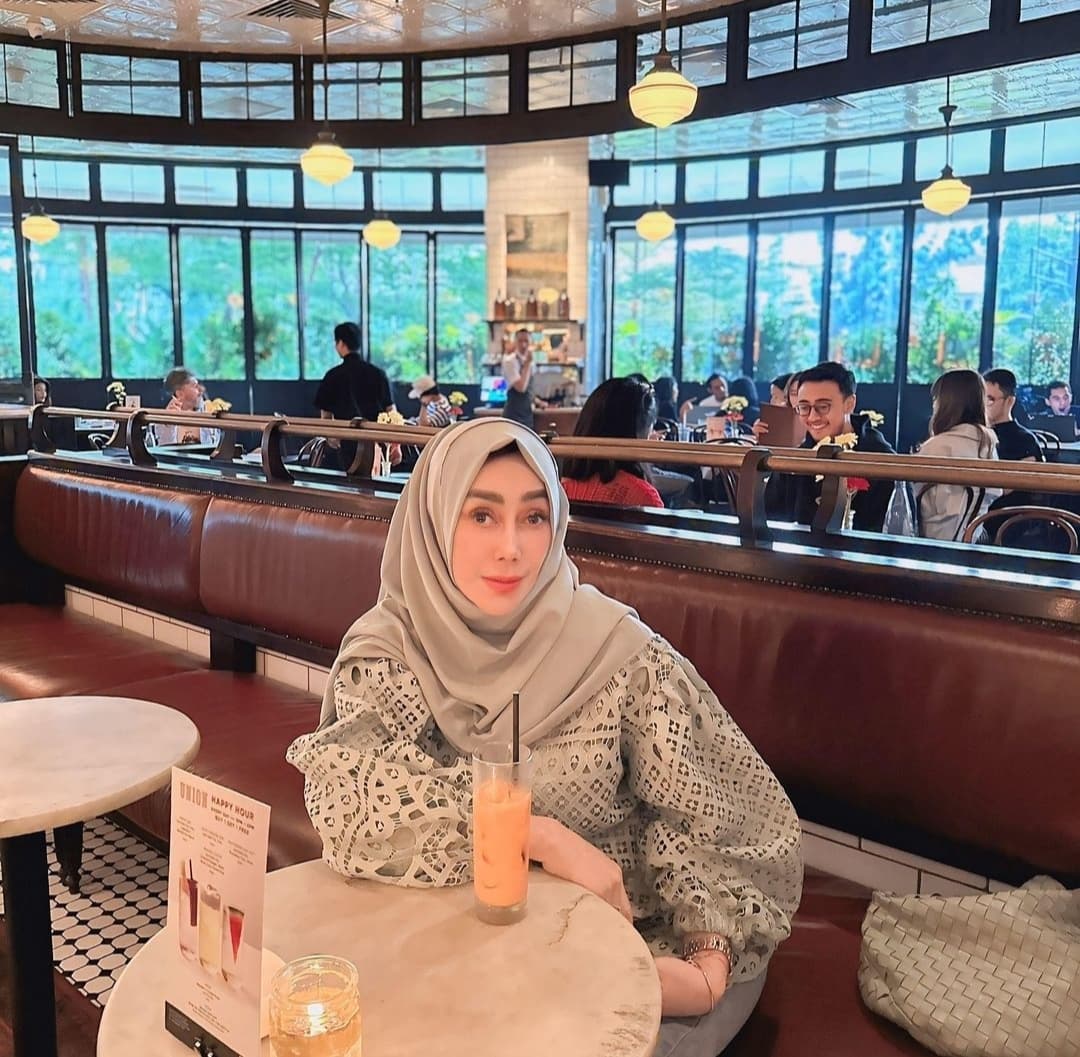 Amy Qanita Pilih Perawatan ke Korea Dibanding Operasi Plastik