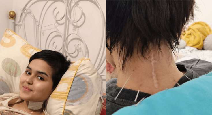 Mengenal Spinal Cord Injury, Penyakit Cedera Tulang Belakang yang Dikisahkan dalam Film Laura!