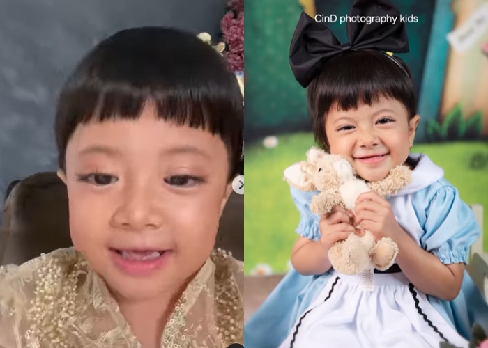 Ketahui Penyebab dan Ciri-ciri Osteogenesis Imperfecta, Penyakit Tulang yang Diidap Zehan Almira