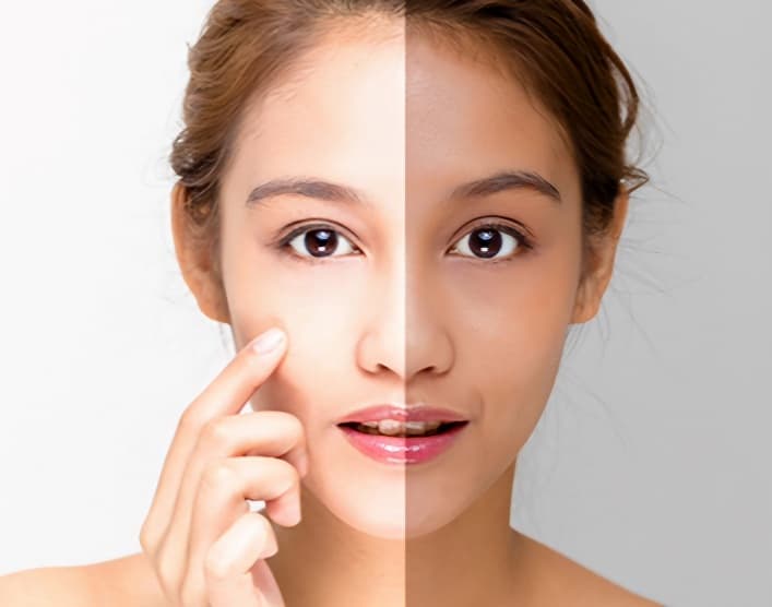 7 Cara Mendapatkan Kulit Sehat Tanpa Skincare Mahal