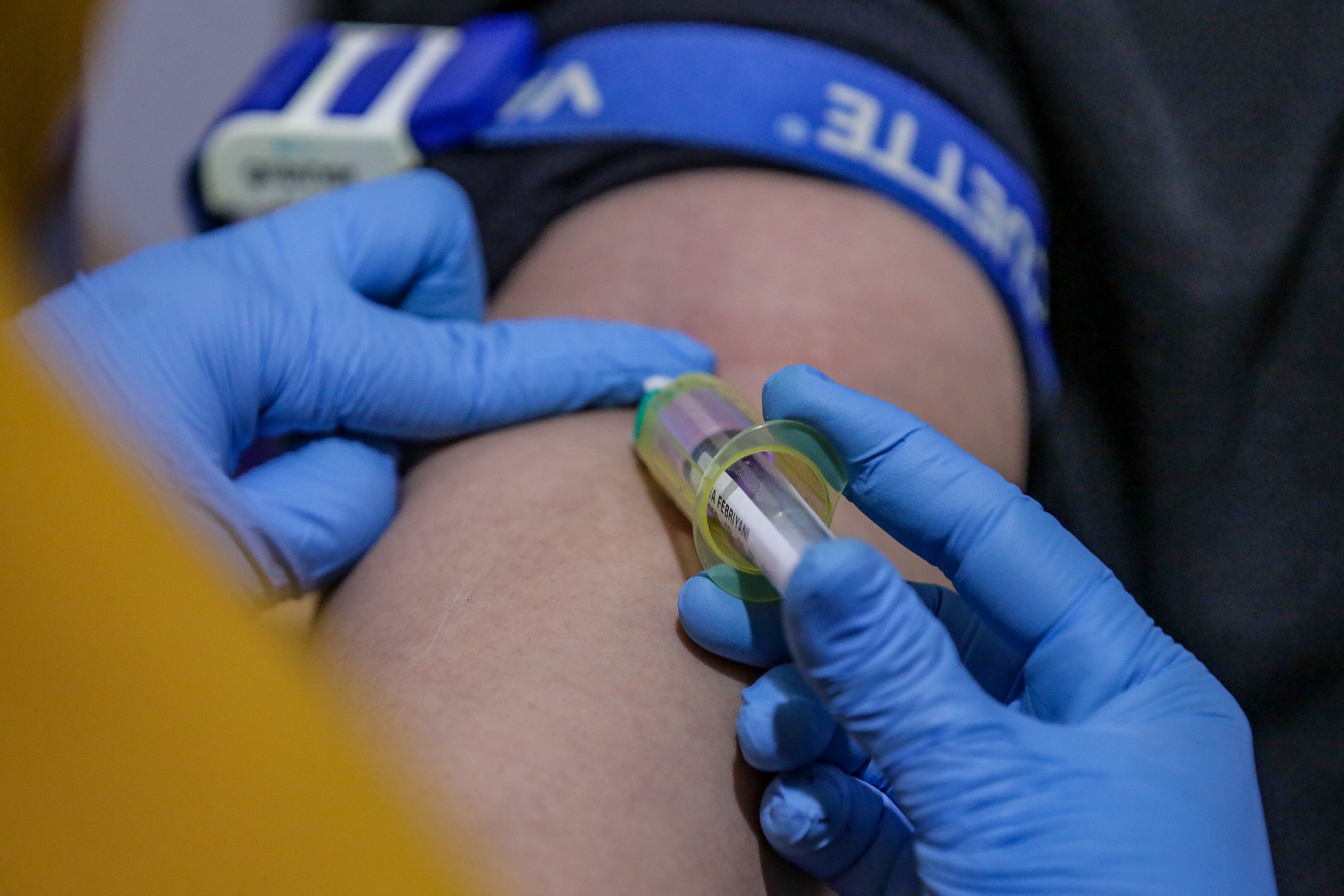 Pj Gubernur DKI Tegaskan Pengawasan PKG: Kesehatan Warga adalah Prioritas Utama