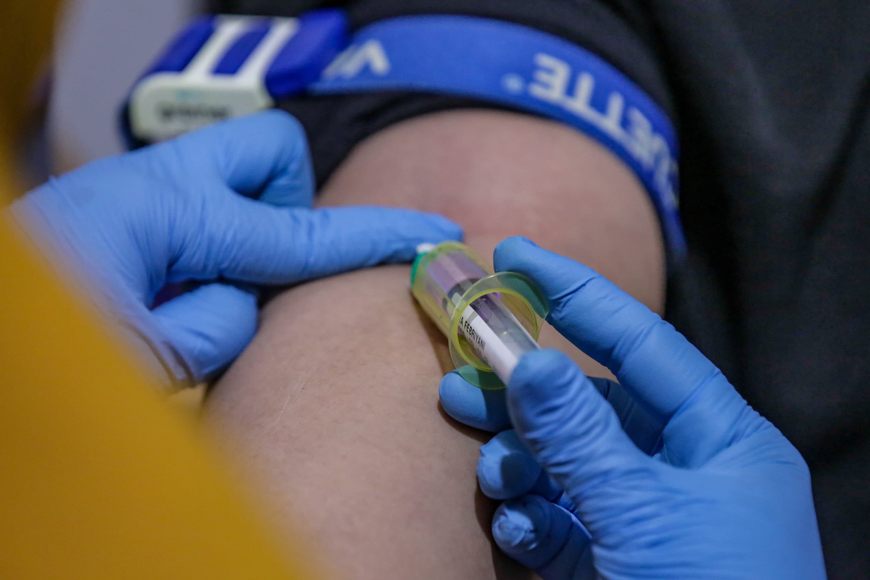 Pj Gubernur DKI Tegaskan Pengawasan PKG: Kesehatan Warga adalah Prioritas Utama