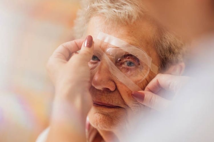 7 Fakta Penting Perbedaan Herbal untuk Katarak dan Glaukoma yang Wajib Kamu Ketahui