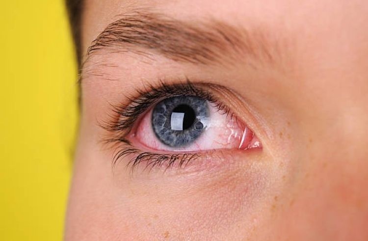 7 Tanaman Obat untuk Mata Merah dan Iritasi yang Terbukti Ampuh Menurut Riset Kesehatan