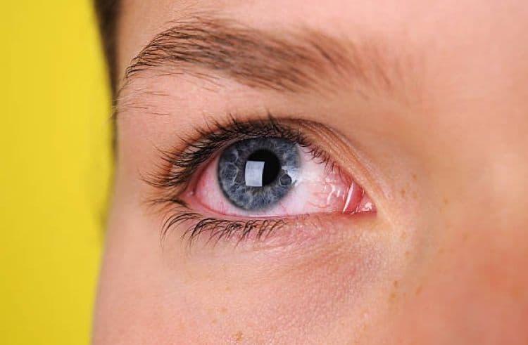 7 Tanaman Obat untuk Mata Merah dan Iritasi yang Terbukti Ampuh Menurut Riset Kesehatan