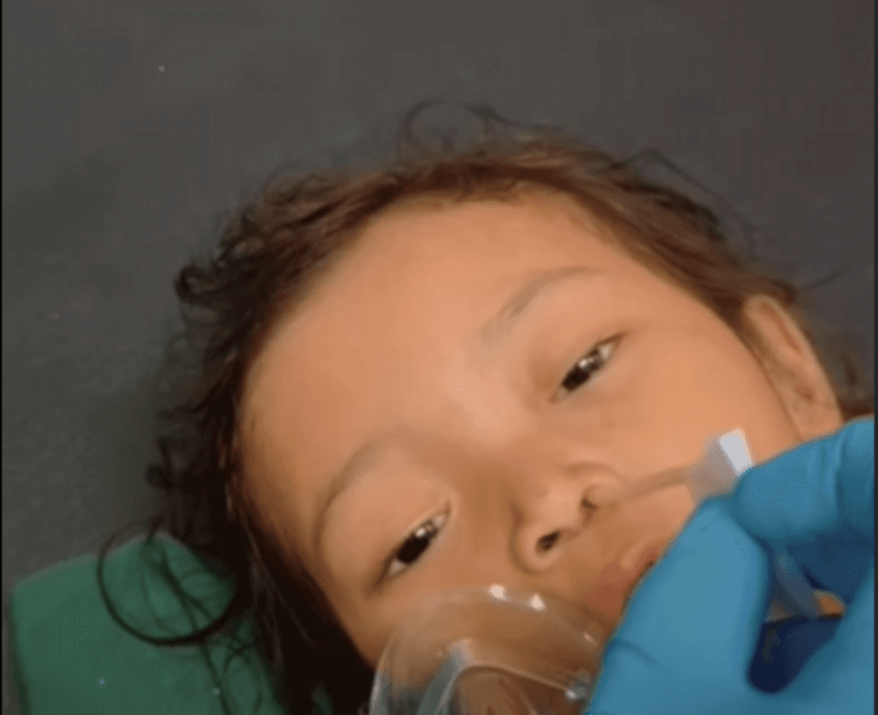 Kronologi Kematian Raya, Balita Sukabumi yang Tubuhnya Dipenuhi Cacing hingga ke Otak