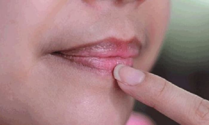 Penyebab Bibir Hitam pada Perokok dan Cara Menguranginya