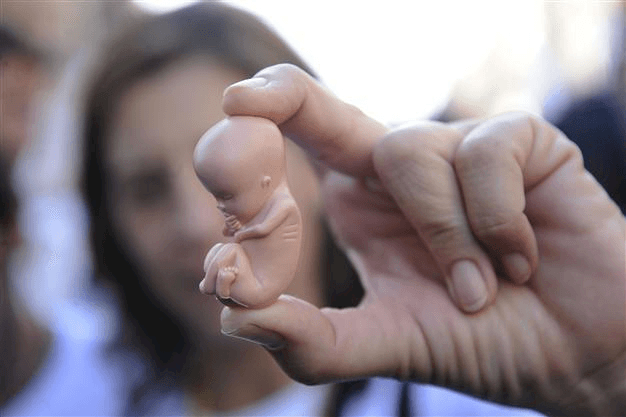 Berat Janin Tak Bertambah Sesuai Usia Kehamilan, Kenali Penyebab dan Cara Mengatasinya